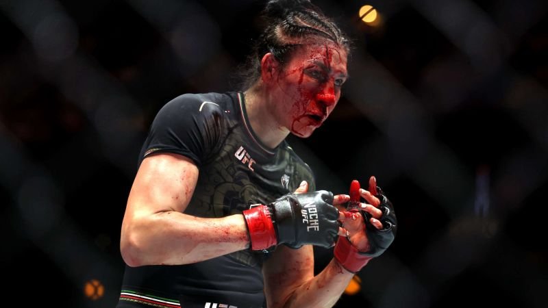 Irene Aldana: Su increíble recuperación tras la mayor lesión en la historia de la UFC